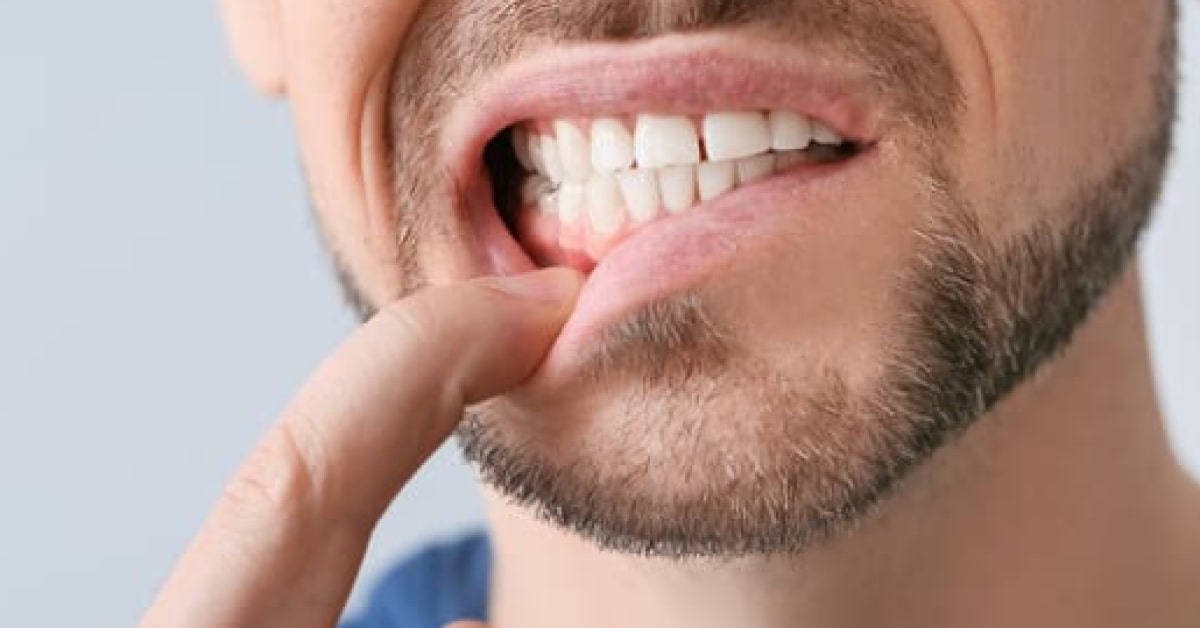 Preventive Measures for Gum Disease